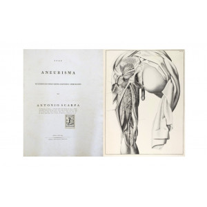 Scarpa, Antonio. Sull’aneurisma riflessioni ed osservazioni anatomico-chirurgiche. Pavia, nella tipografia Bolzani, 1804.